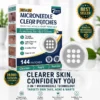 Hiskin Microneedle Clear Patches Skin Tag Remover