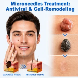 Hiskin Microneedle Clear Patches Skin Tag Remover